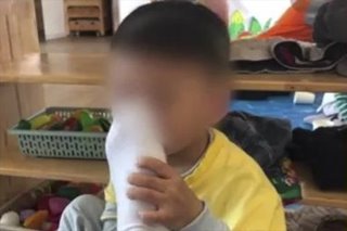 Kindergarten teacher in China sacked for posting photos of boy forced to smell his feet