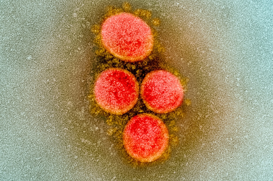 Transmission electron micrograph of SARS-CoV-2 virus particles, isolated from a patient. Image captured and color-enhanced at the NIAID Integrated Research Facility (IRF) in Fort Detrick, Maryland. Credit: NIAID/file