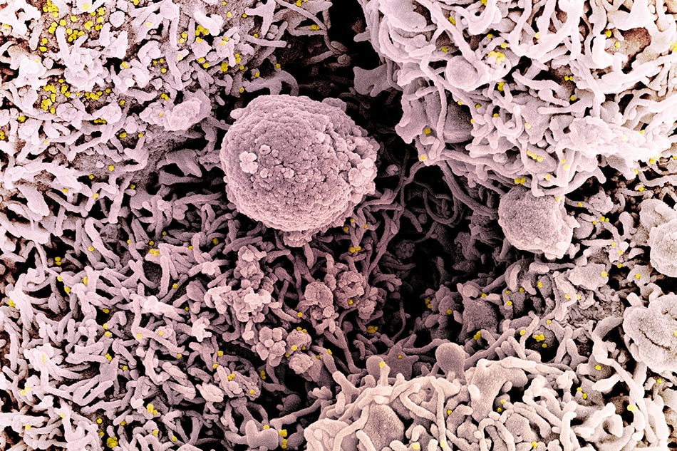 Colorized scanning electron micrograph of a cell (pink) infected with a variant strain of SARS-CoV-2 virus particles (UK B.1.1.7; gold), isolated from a patient sample. Image captured at the NIAID Integrated Research Facility (IRF) in Fort Detrick, Maryland. Photo by NIAID