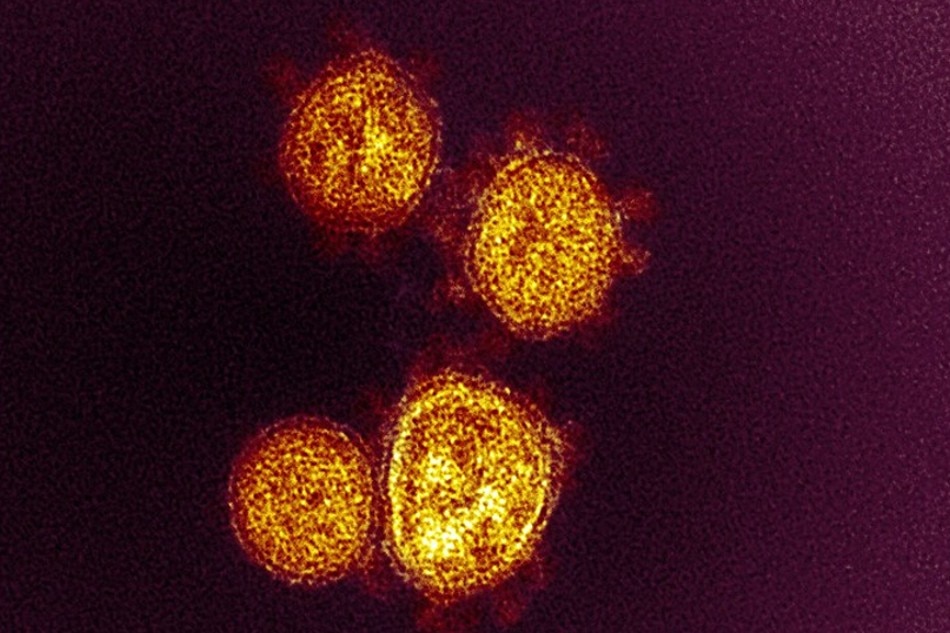 This transmission electron microscope image shows SARS-CoV-2—also known as 2019-nCoV, the virus that causes COVID-19. Virus particles are shown emerging from the surface of a cell cultured in the lab. The spikes on the outer edge of the virus particles give coronaviruses their name, crown-like. Image captured and colorized at Rocky Mountain Laboratories in Hamilton, Montana. Credit: NIAID