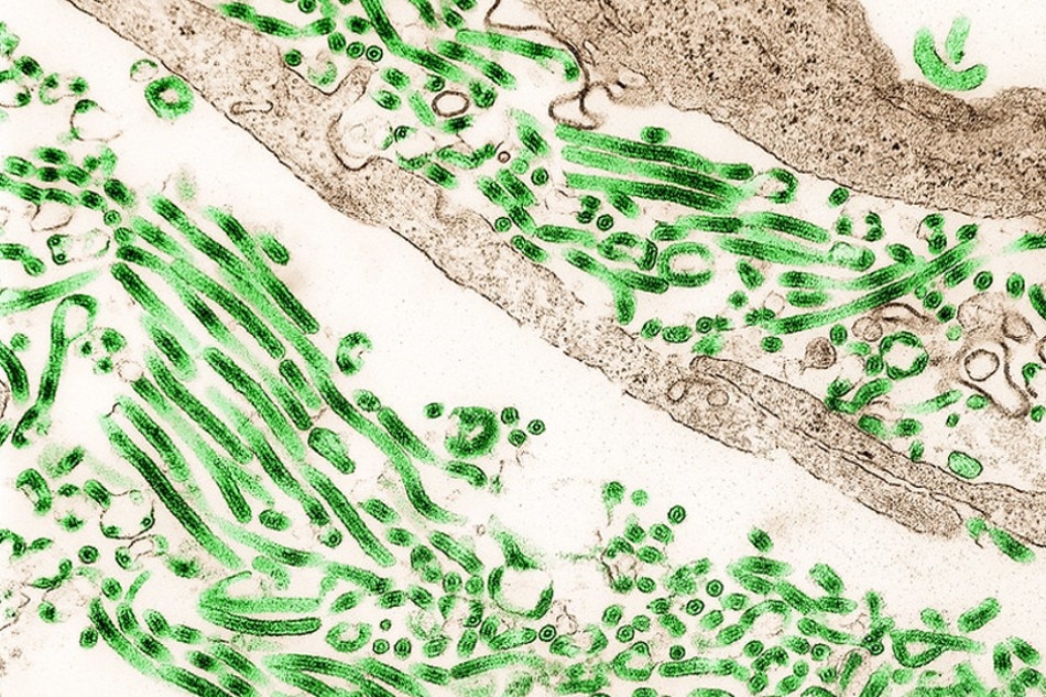 Colorized transmission electron micrograph of Ebola virus particles (green) found both as extracellular particles and budding particles from chronically-infected African green monkey kidney cells (brown). Image captured and color-enhanced at the NIAID Integrated Research Facility in Ft. Detrick, Maryland. Credit: NIAID