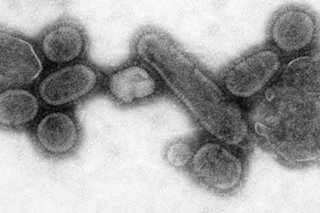 More Americans lost to COVID-19 than 1918 flu pandemic