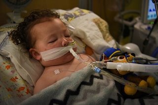 Toddler on ventilator fights for his life