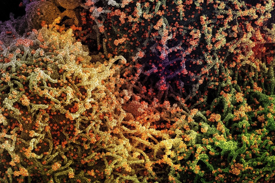 Scanning electron micrograph of a cell infected with a variant strain of SARS-CoV-2 virus particles (orange), isolated from a patient sample and colorized in Halloween colors. Image captured at the NIAID Integrated Research Facility (IRF) in Fort Detrick, Maryland. Stay safe and have a Happy Halloween! Credit: NIAID