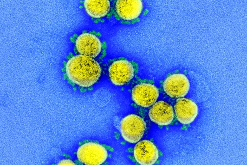 Transmission electron micrograph of SARS-CoV-2 virus particles, isolated from a patient. Image captured and color-enhanced at the NIAID Integrated Research Facility (IRF) in Fort Detrick, Maryland. Photo courtesy of National Institute of Allergy and Infectious Diseases/file