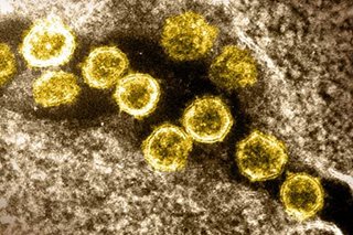 More severe COVID-19 variant 'nearly impossible' due to Omicron: expert
