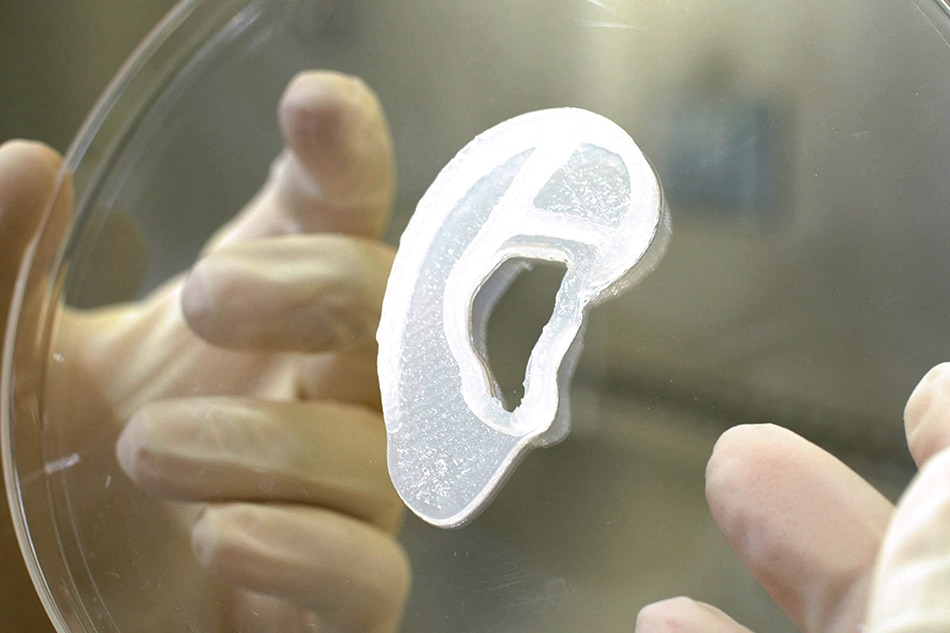 This undated image courtesy of 3D Bio Therapeutics, shows a 3D bioimplant of an ear lobe. A US medical team said on June 2, 2022, they had reconstructed a human ear using the patient's own tissue to create a 3D bioimplant, a pioneering procedure they hope can be used to treat people with a rare birth defect. The surgery was performed as part of an early-stage clinical trial to evaluate the safety and efficacy of the implant for people with microtia, a rare birth defect in which the external ear is small and not formed properly. AuriNovo, as the implant is called, was developed by 3DBio Therapeutics while the surgery was led by Arturo Bonilla, founder and director of the Microtia-Congenital Ear Deformity Institute in San Antonio, Texas. Handout / 3D Bio Therapeutics / AFP