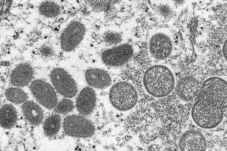 This undated electron microscopic (EM) handout image provided by the Centers for Disease Control and Prevention depicts a monkeypox virion, obtained from a clinical sample associated with the 2003 prairie dog outbreak. Photo by Cynthia S. Goldsmith, Centers for Disease Control and Prevention/AFP/file
