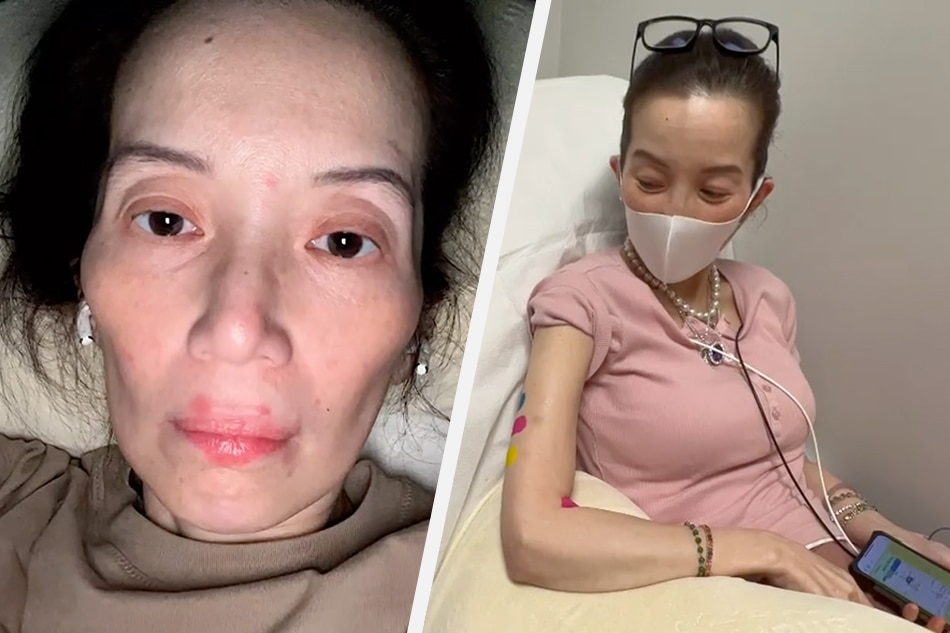 Kris Aquino shares photos of the physical toll of her autoimmune condition. Screenshot/Instagram: @krisaquino