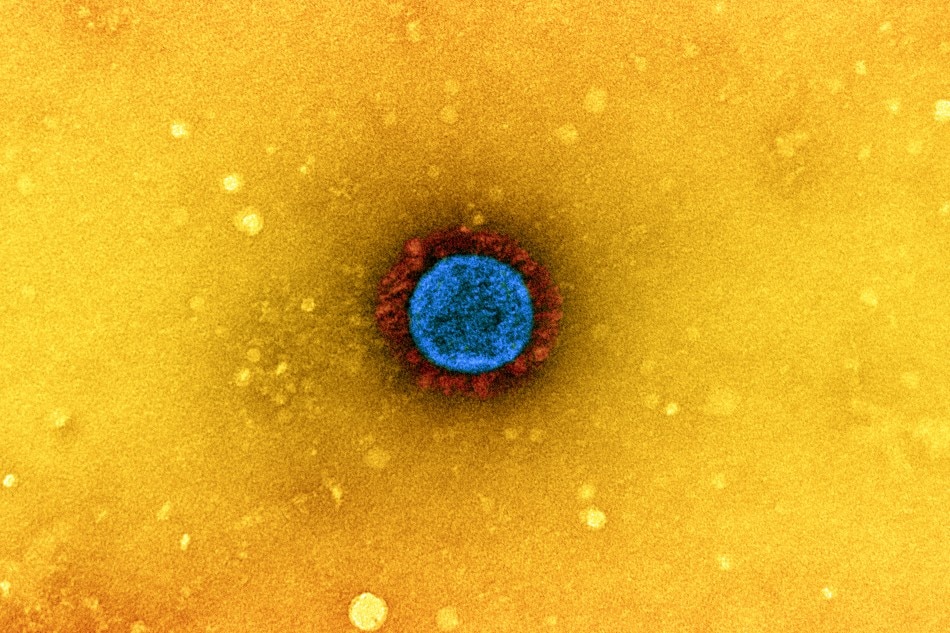 Transmission electron micrograph of a SARS-CoV-2 virus particle (UK B.1.1.7 variant), isolated from a patient sample and cultivated in cell culture. The prominent projections (red) seen on the outside of the virus particle (blue) are spike proteins. This fringe of proteins enables the virus to attach to and infect host cells and then replicate. Image captured at the NIAID Integrated Research Facility (IRF) in Fort Detrick, Maryland. Credit: NIAID