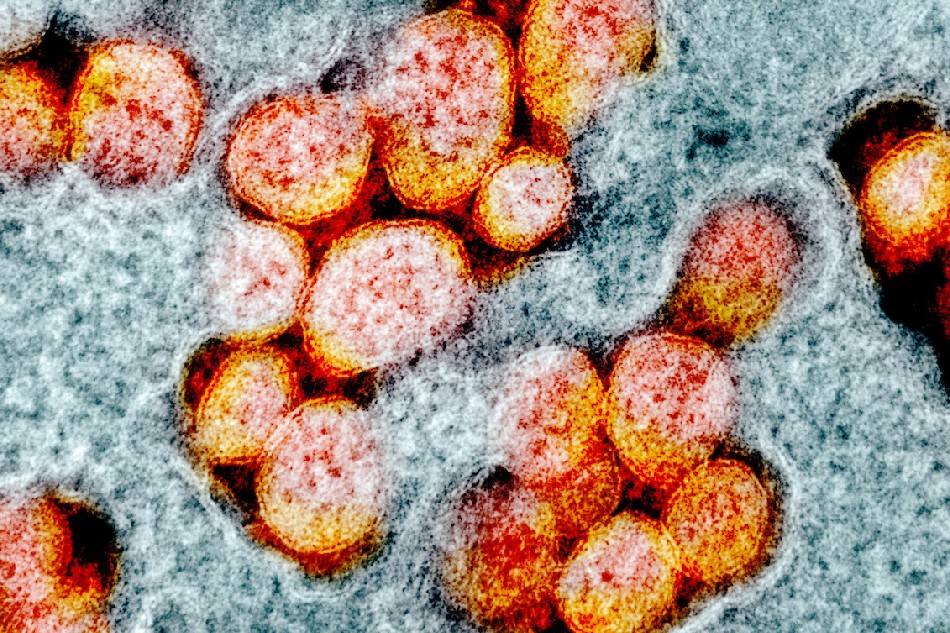 Transmission electron micrograph of SARS-CoV-2 virus particles, isolated from a patient. Image captured and color-enhanced at the NIAID Integrated Research Facility (IRF) in Fort Detrick, Maryland. NIAID