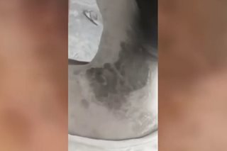Magkapatid sinabuyan ng asido ng riding-in-tandem