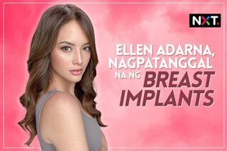  Ellen Adarna, nagpatanggal na ng breast implants 
