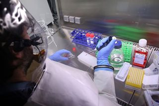 Marburg virus entering PH has 'low' probability: DOH