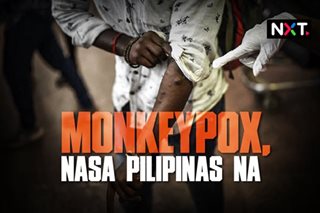 Monkeypox, nasa Pilipinas na 