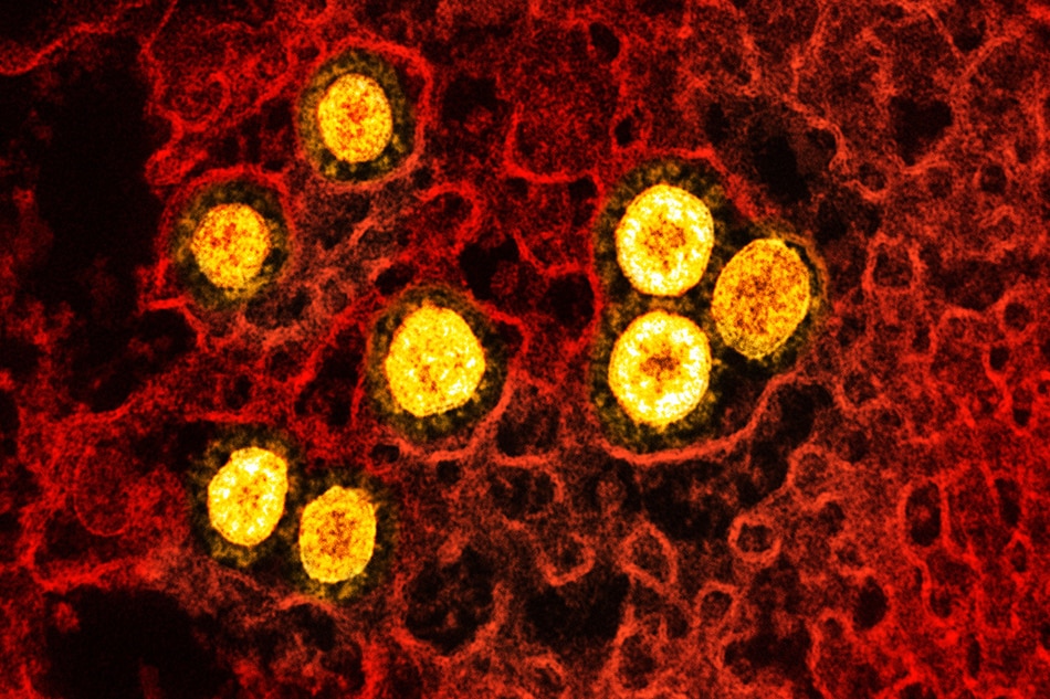 Transmission electron micrograph of SARS-CoV-2 Omicron virus particles (yellow) replicating within the cytoplasm of an infected CCL-81 cell (red). Image captured at the NIAID Integrated Research Facility (IRF) in Fort Detrick, Maryland. Credit: NIAID