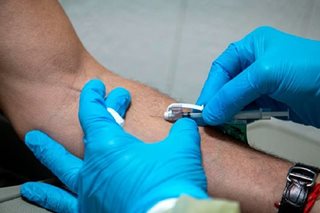 Foreigners flock to Canada for monkeypox vaccine