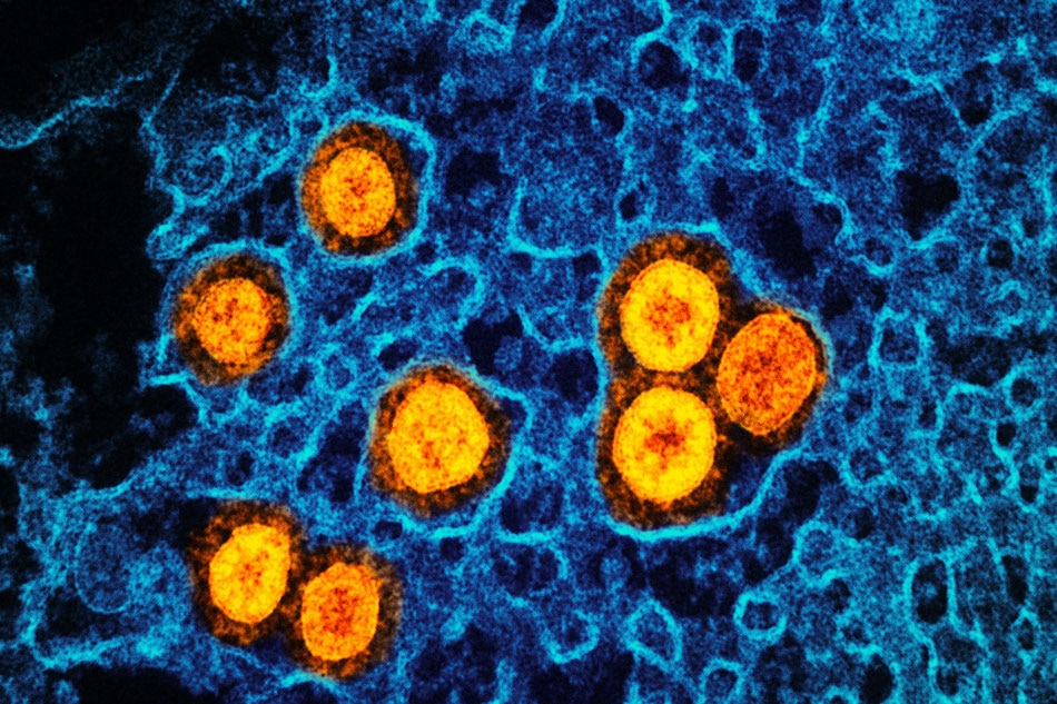 Transmission electron micrograph of SARS-CoV-2 Omicron virus particles (orange) replicating within the cytoplasm of an infected CCL-81 cell (blue). Image captured at the NIAID Integrated Research Facility (IRF) in Fort Detrick, Maryland. Credit: NIAID