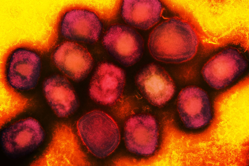 Colorized transmission electron micrograph of monkeypox virus particles (red) cultivated and purified from cell culture. Image captured at the NIAID Integrated Research Facility (IRF) in Fort Detrick, Maryland. Credit: NIAID