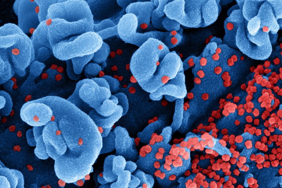 Colorized scanning electron micrograph of a cell infected with the Omicron strain of SARS-CoV-2 virus particles (red), isolated from a patient sample. Image captured at the NIAID Integrated Research Facility (IRF) in Fort Detrick, Maryland. NIAID