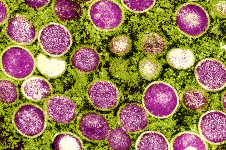 Colorized transmission electron micrograph of monkeypox particles (pink) found within an infected cell (green), cultured in the laboratory. Image captured and color-enhanced at the NIAID Integrated Research Facility (IRF) in Fort Detrick, Maryland. NIAID
