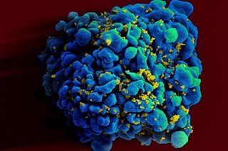 DOH sees rise in HIV cases