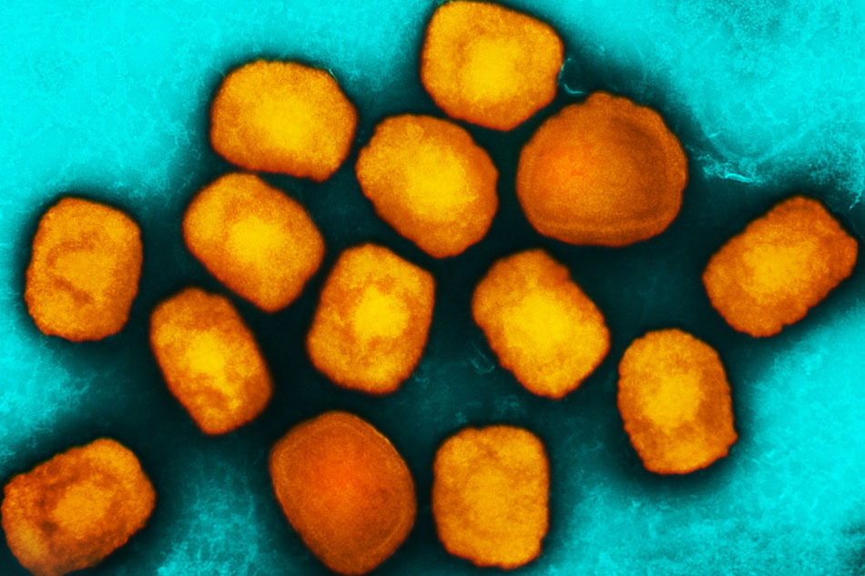 Colorized transmission electron micrograph of monkeypox virus particles (orange) cultivated and purified from cell culture. Image captured at the NIAID Integrated Research Facility (IRF) in Fort Detrick, Maryland. Credit: NIAID
