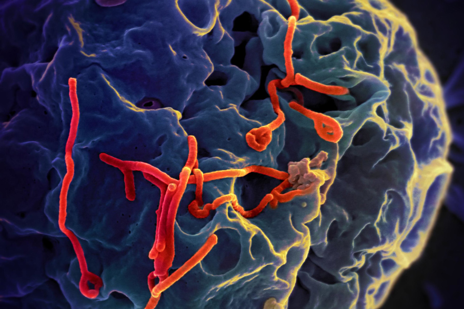 Scanning electron micrograph of Ebola virus budding from the surface of a Vero cell (African green monkey kidney epithelial cell line. Credit: NIAID