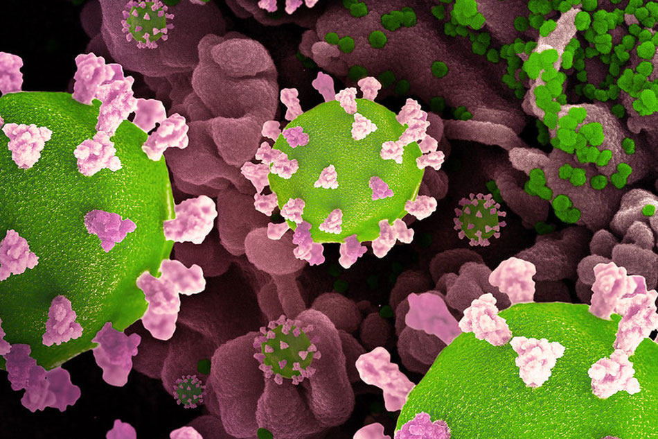 Creative rendition of SARS-CoV-2, displaying 3D prints of virus particles (colorized green and pink; the green virus surface is covered with pink spike proteins that enable the virus to enter and infect human cells), and a background image that is a colorized scanning electron micrograph of a cell (pink) infected with the Omicron strain of the virus (green). Note: not to scale. Credit: NIAID