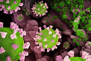 Masks, boosters key in fighting new COVID XBB variant: expert