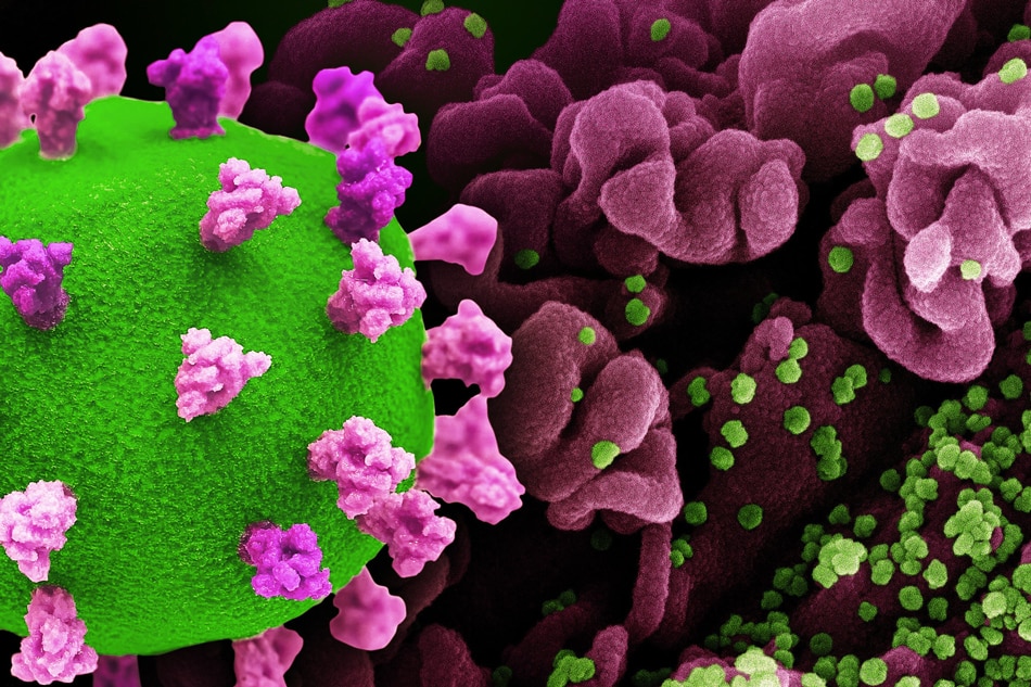 Creative rendition of SARS-CoV-2, displaying a 3D print of the virus (colorized green and pink; the green virus surface is covered with pink spike proteins that enable the virus to enter and infect human cells), and a background image that is a colorized scanning electron micrograph of a cell (pink) infected with the Omicron strain of the virus (green). Note: not to scale. Credit: NIAID