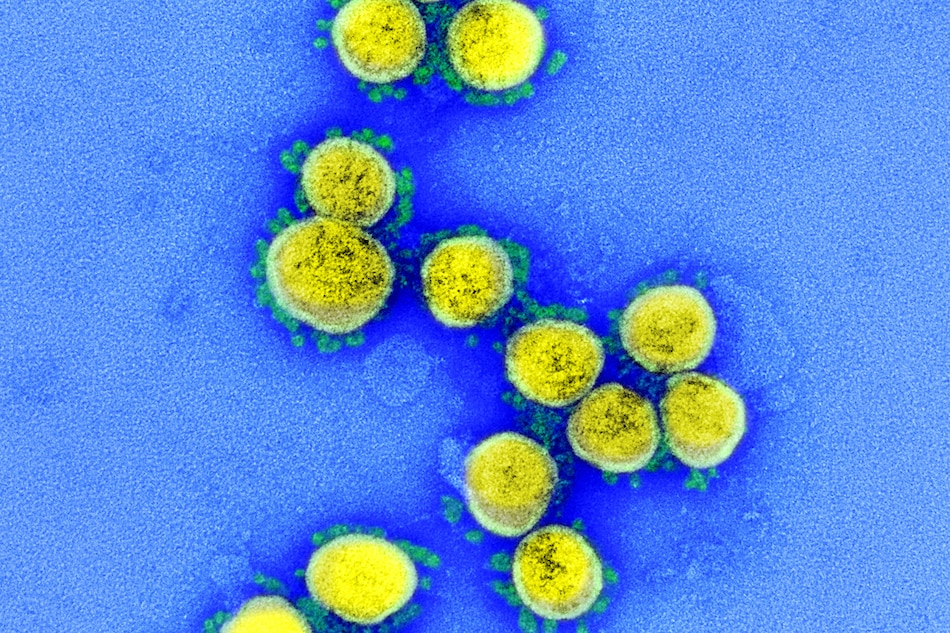 Transmission electron micrograph of SARS-CoV-2 virus particles, isolated from a patient. Image captured and color-enhanced at the NIAID Integrated Research Facility (IRF) in Fort Detrick, Maryland. Photo courtesy of National Institute of Allergy and Infectious Diseases