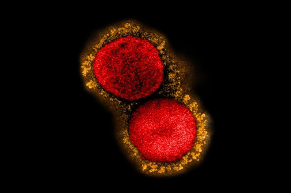 Transmission electron micrograph of SARS-CoV-2 virus particles (UK B.1.1.7 variant), isolated from a patient sample and cultivated in cell culture. Image captured at the NIAID Integrated Research Facility (IRF) in Fort Detrick, Maryland. Credit: NIAID