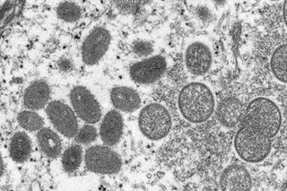 EU eyes smallpox vaccine for monkeypox, says regulator