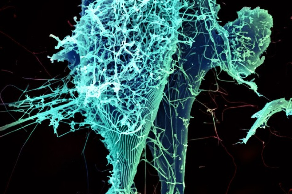 String-like Ebola virus particles are shedding from an infected cell in this electron micrograph. NIAID