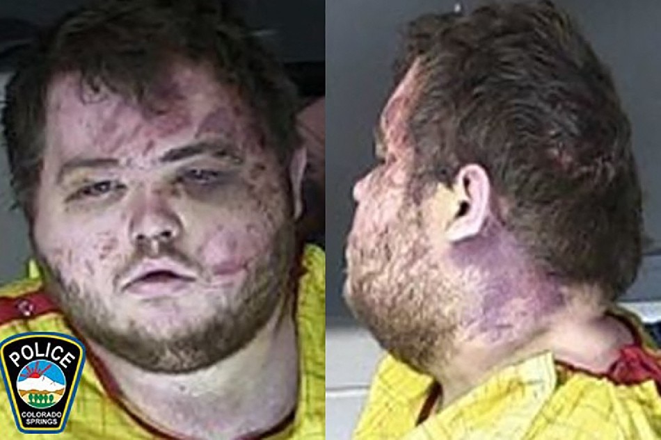 This handout photo released by the Colorado Springs Police Department on Novemver 23, 2022, shows the mugshot of Anderson Lee Aldrich, suspect in the club Q shooting. Aldrich has not been formally charged, but is being held on suspicion of murder. Under Colorado's judicial system, formal charges are not expected for another 10 days. The hearing came less than four days after a gun-wielding attacker stormed Club Q in Colorado Springs, strafing customers and staff.  Colorado Springs Police Department / AFP