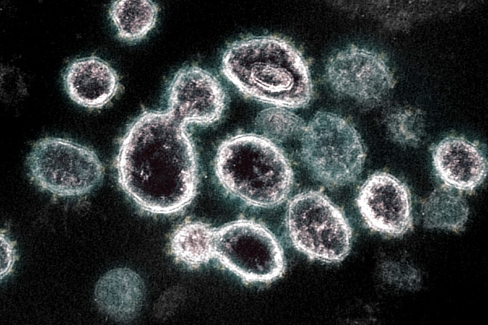 This undated handout image obtained March 28, 2021, courtesy of the National Institute of Allergy and Infectious Diseases/ NIH shows a transmission electron microscope image of SARS-CoV-2, the virus that causes COVID-19. National Institute of Allergy and Infectious Diseases handout via AFP/file