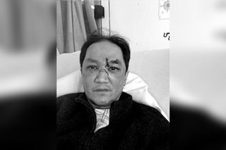 Two Filipinos injured in separate NY attacks