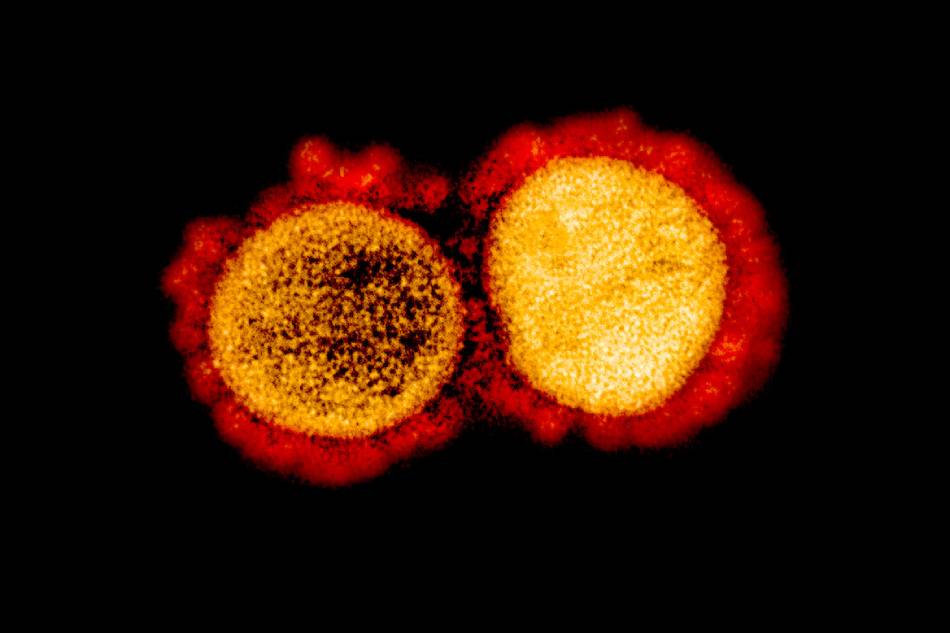 Transmission electron micrograph of SARS-CoV-2 virus particles, isolated from a patient. Image captured and color-enhanced at the NIAID Integrated Research Facility (IRF) in Fort Detrick, Maryland. NIAID