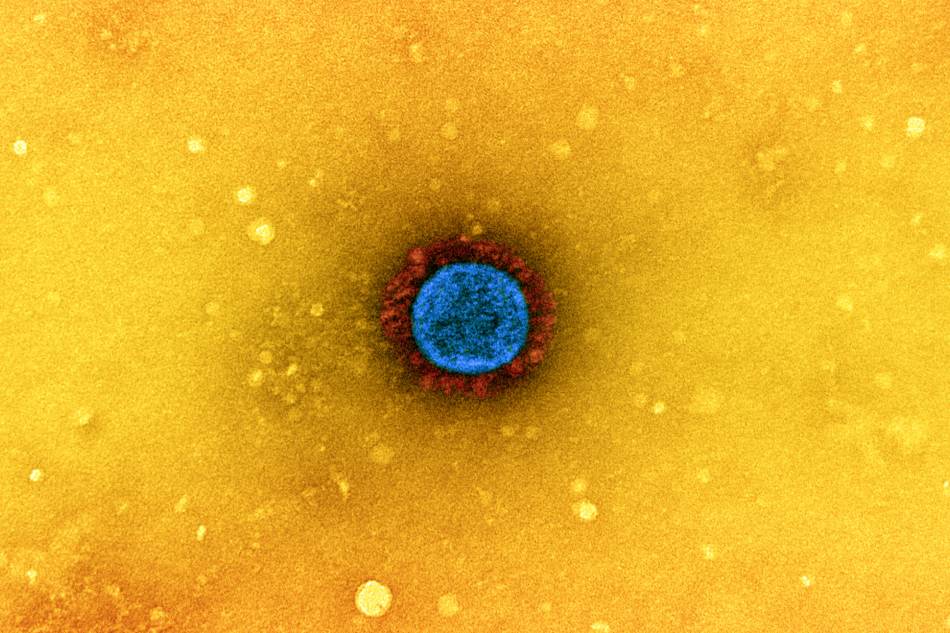 SARS-CoV-2 virus particle (UK B.1.1.7 variant), isolated from a patient sample and cultivated in cell culture. Credit: NIAID
