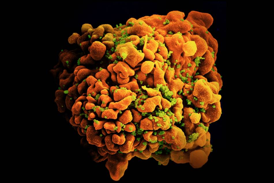 Scanning electron micrograph of an HIV-infected H9 T cell. Credit: NIAID