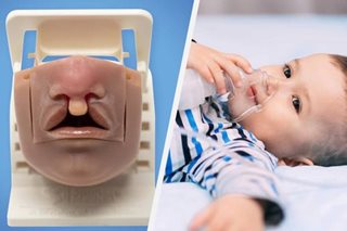 Health shorts: Bilateral cleft lip simulator and more