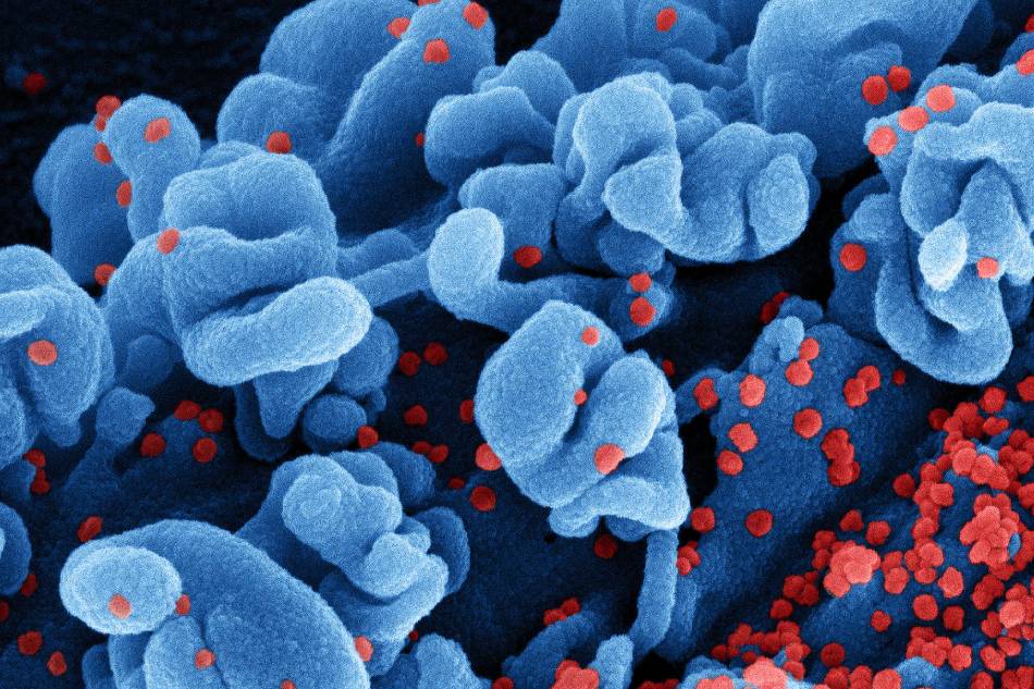 Colorized scanning electron micrograph of a cell infected with the Omicron strain of SARS-CoV-2 virus particles (red), isolated from a patient sample. Image captured at the NIAID Integrated Research Facility (IRF) in Fort Detrick, Maryland. NIAID