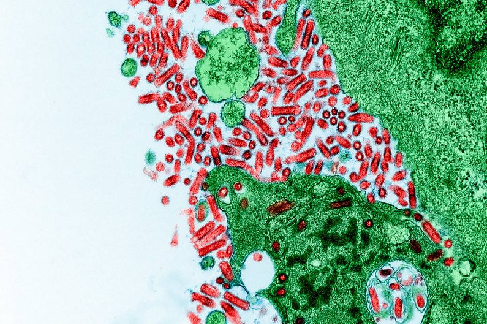 Colorized transmission electron micrograph of BSK Cells in culture, heavily infected with Rabies Virus. Image captured and color-enhanced at the NIAID Integrated Research Facility (IRF) in Fort Detrick, Maryland. Credit: NIAID