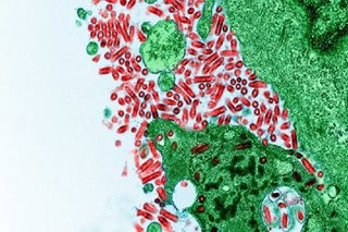 Philippines rabies deaths rise to 284