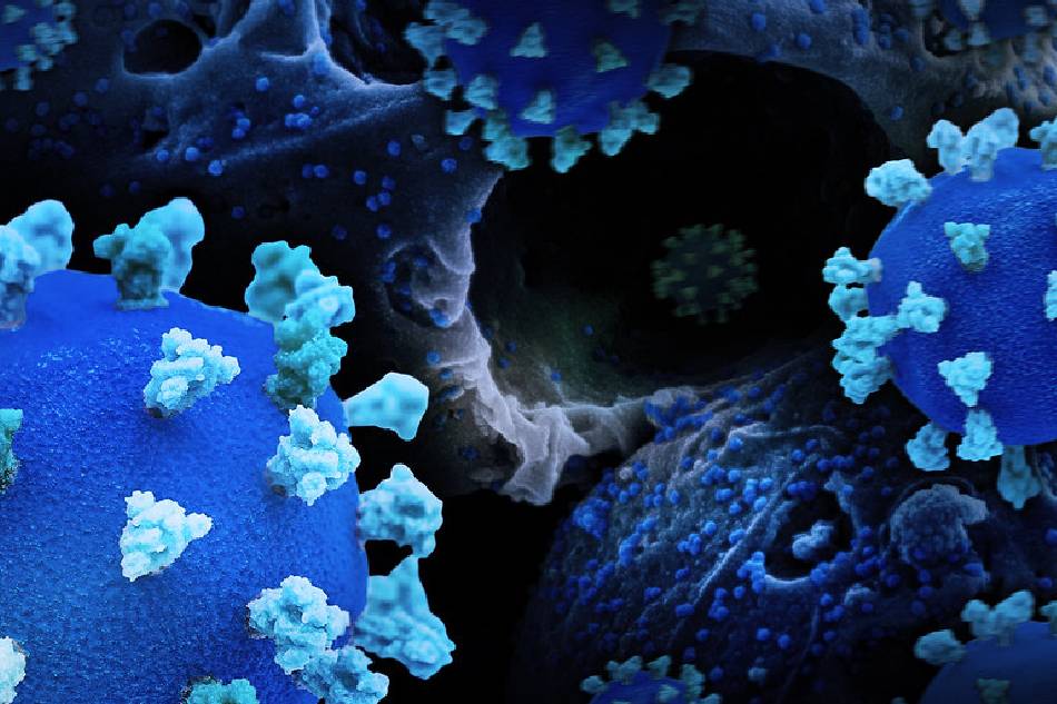 Creative rendition of SARS-CoV-2, displaying 3D prints of virus particles (colorized blue and teal; the blue virus surface is covered with teal spike proteins that enable the virus to enter and infect human cells), and a background image that is a colorized scanning electron micrograph of a cell infected with the omicron strain of the virus (blue). Note: not to scale. NIAID