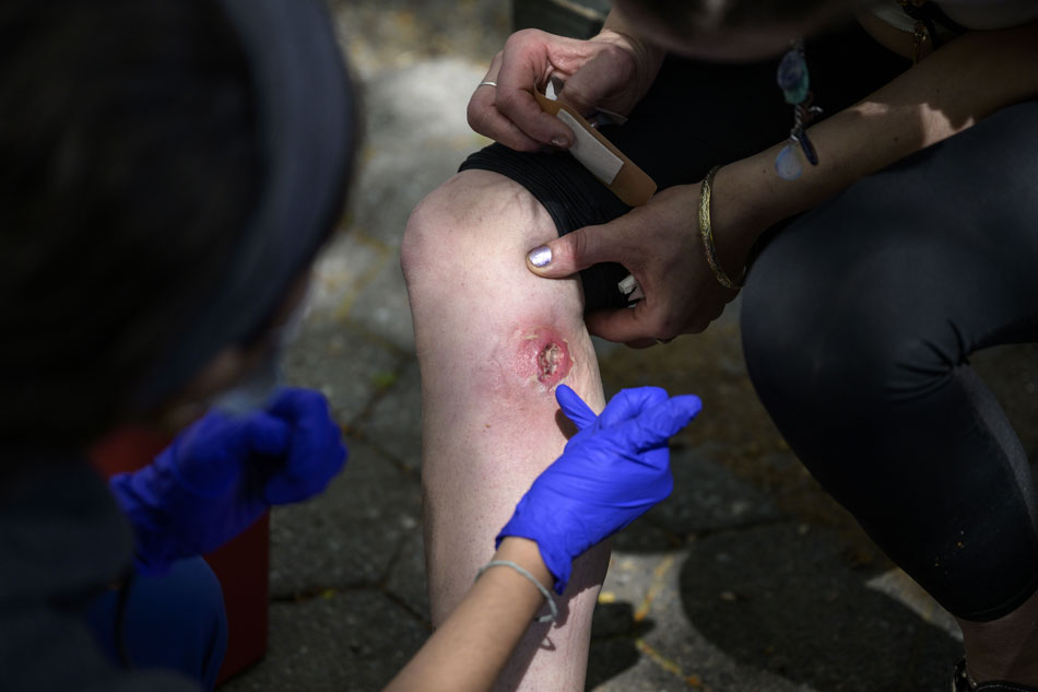  Registered nurse Jazmyna Fanini cleans the wound of drug user Crystal Mojica in a park in New York City on April 24, 2023. The tranquillizer, approved for veterinary use by the US Food and Drug Administration (FDA), has infiltrated the illegal drugs market in the US, with producers increasingly using it to augment fentanyl. Overdose deaths where tranq was detected have soared in recent years and in April the White House designated the drug an 