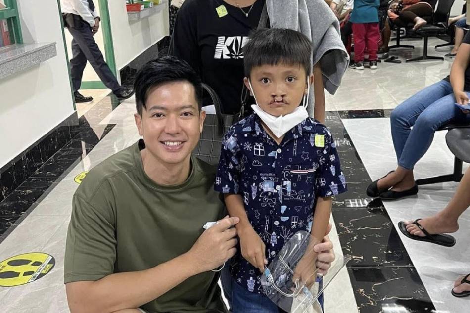 Ronnie Liang transforms smiles as he builds foundation for children with cleft lip and palate. Handout