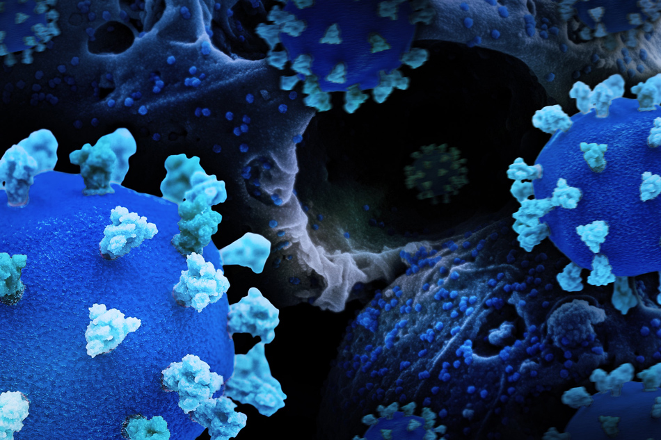 Creative rendition of SARS-CoV-2, displaying 3D prints of virus particles (colorized blue and teal; the blue virus surface is covered with teal spike proteins that enable the virus to enter and infect human cells), and a background image that is a colorized scanning electron micrograph of a cell infected with the Omicron strain of the virus (blue). Note: not to scale. Credit: NIAID