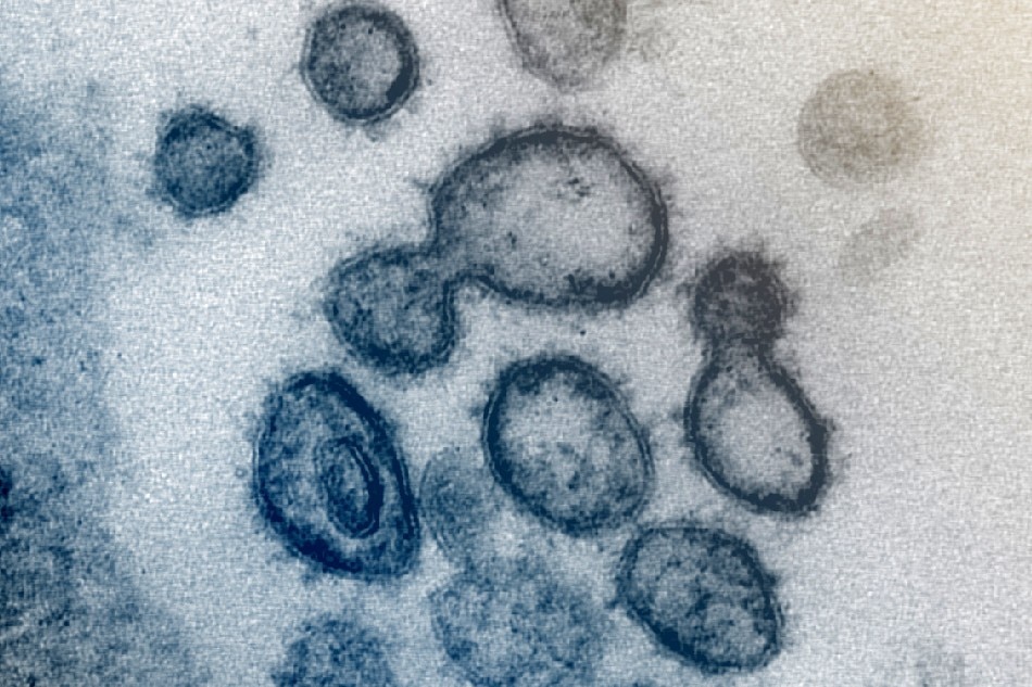 This transmission electron microscope image shows SARS-CoV-2, the virus that causes COVID-19, isolated from a patient in the US. Virus particles are shown emerging from the surface of cells cultured in the lab. The spikes on the outer edge of the virus particles give coronaviruses their name, crown-like. Credit: NIAID-RML